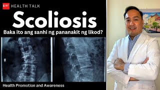 What is Scoliosis Causes Symptoms and Treatment [upl. by Aikem575]