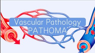 Vasculitis part 22 PATHOMA Beurger diseaseSmall vessel vasculitis [upl. by Yme602]