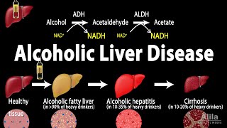 Alcoholic Liver Disease Animation [upl. by Oiruam]