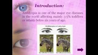 Therapies to cure Amblyopia [upl. by Henleigh]