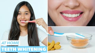 Easy Teeth Whitening at Home [upl. by Mirth]