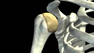 Shoulder joint dislocation [upl. by Marylee]