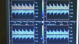 Multigon TOC 2M Transcranial Doppler [upl. by Mages197]