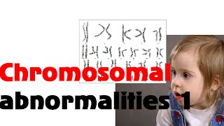 Chromosomal abnormalities 1 [upl. by Derian606]