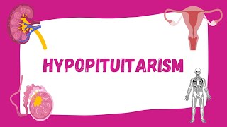 Hypopituitarism  Causes Symptoms Diagnosis Treatment  Endocrinology [upl. by Netsirhk789]