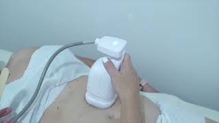 Liposonix e Hifu 7D en Sevilla [upl. by Marianna]