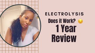 Electrolysis Hair Removal 1 Year Review [upl. by Nohtanoj]