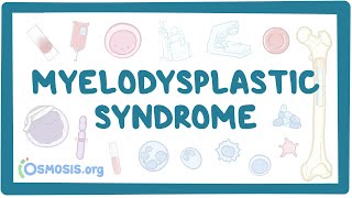 Myelodysplastic syndromes  causes symptoms diagnosis treatment pathology [upl. by Sidoeht]