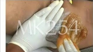 BRAZILIAN BIKINI SUGAR WAXING LOWER BODY WAXINGbrazilian wax waxing sugarwaxing sugaring viral [upl. by Courtland607]