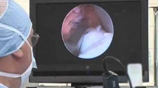 Equine Arthroscopic Surgery [upl. by Filler]