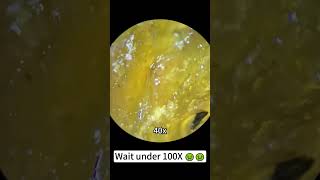 What Fried Chicken Dumbstick REALLY Looks Like Under a Microscope [upl. by Pratte]