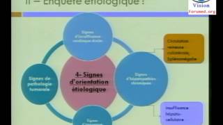 Conduite à Tenir devant une Ascite Abdominale Cas Clinique physiopathologie Symptomes [upl. by Feriga926]