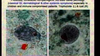 Parasites and Cancer  Dr Omar Amin [upl. by Adekahs]