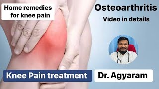 Osteoarthritis Video  Knee Pain Management  knee pain treatment osteoarthritis kneepain doctor [upl. by Gussi]