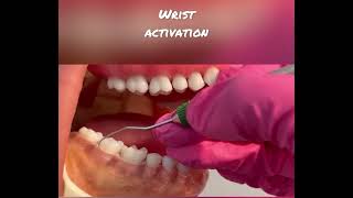 Demonstration of the 1112 Explorer on posterior teeth Teeth numbers 3129 [upl. by Idnyl]