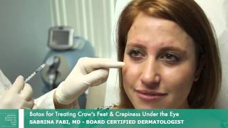 Botox for Crows Feet  Botox Around Eyes  Dr Fabi [upl. by Rotce453]