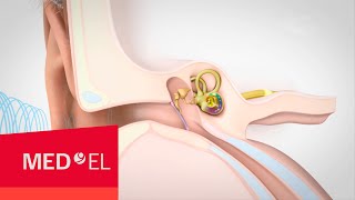 Video about Hearing and How it Works  MEDEL [upl. by Treve]