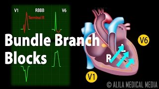 Bundle Branch Block Animation [upl. by Hilly]