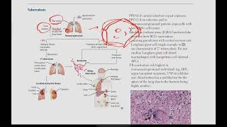 Mycobacteria Tuberculosis Leprosy  Microbiology  14  First Aid USMLE in UrduHindi [upl. by Worrad649]