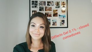 Differin Gel 01  closed comedones [upl. by Myrilla]