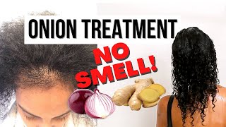 ONION TREATMENT WITHOUT THE SMELL Weekly Onion Hair Growth Treatment NO SMELL [upl. by Offen]