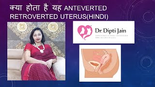 क्या होता है यह Anteverted Retroverted UTERUSHINDI [upl. by Tadashi]