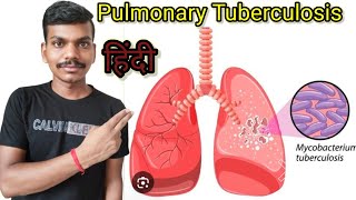 Pulmonary Tuberculosis in hindi  Definition  StageCause  pathophysiology MSN [upl. by Seiden5]