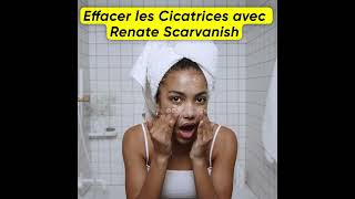 Crème pour Effacer Cicatrices  Renate Scarvanish [upl. by Anauqahc995]