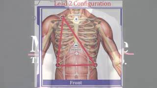 Electrode Placement Training for Electrocardiogram ECG [upl. by Fesoy8]