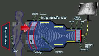 Fluoroscopy  Xray intensifier tube  Basic functions [upl. by Akerahs776]