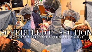 SCHEDULED CSECTION BIRTH VLOG  5th REPEAT C  SECTION  POSITIVE EXPERIENCE  LABOR AND DELIVERY [upl. by Dnarud]