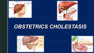 Obstetric Cholestasis RCOG Guideline [upl. by Irtak]