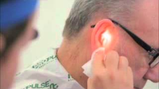 Ear Irrigation with a Propulse NG Ear Irrigatorwmv [upl. by Rednas990]