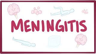 Meningitis  causes symptoms diagnosis treatment pathology [upl. by Carree]