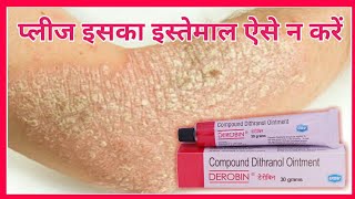 Derobin Cream Uses In Hindi  Derobin Cream Kis Kaam Mein Aata Hai  Derobin Ointment  डेरोबिन [upl. by Ynagoham]