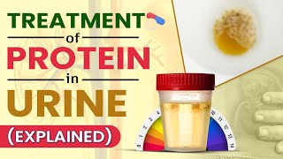 Treatment Of Protein In Urine Explained [upl. by Itra]