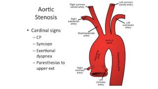 Diseases of the Endocardium [upl. by Kenta]