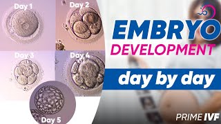 Embryo Development Day By Day in Hindi  Best Blastocyst Clinic in Gurgaon  Prime IVF [upl. by Alrep]