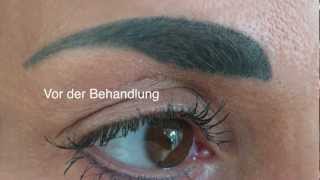 Permanent Makeup Entfernung der Augenbrauen [upl. by Yllitnahc]