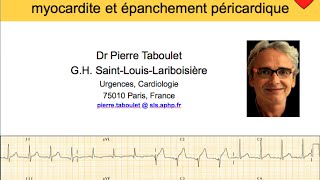 9a Péricardite Myocardite Épanchement péricardique ECG Dr Taboulet [upl. by Linoel60]