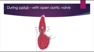 Intracranial Pressure ICP Waves [upl. by Ayomat]