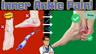 Inside of the Ankle Pain Tarsal Tunnel Syndrome Treatment amp Symptoms [upl. by Letnahs]