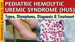 Hemolytic Uremic Syndrome HUS Symptoms Diagnosis amp Treatment In Children [upl. by Dougy]