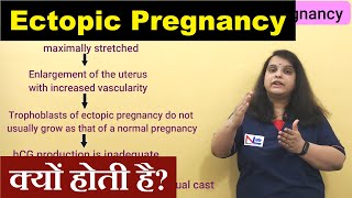 Ectopic Pregnancy in Hindi  Sites of Implantations  Risk Factors  Nursing Lecture [upl. by Norrat]