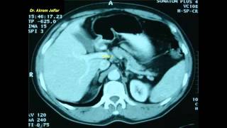 Cross sectional and imaging anatomy of the abdomen [upl. by Etnohc884]