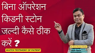 किडनी स्टोन को होम्योपैथिक दवाइयों से जल्दी कैसे ठीक करें  Fast treatment of kidney stones [upl. by Kela]