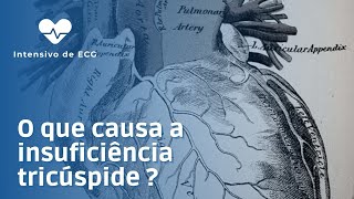 O que causa a insuficiência tricúspide [upl. by Rramed]