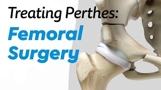 Femoral Surgery for Treating Perthes Disease in Children [upl. by Embry]