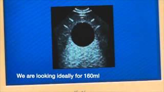 Bladder Scanner Calibration Tutorial from WinHealthcom [upl. by Sayed]