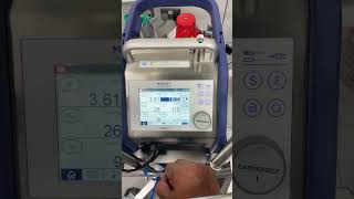 Cardiohelp ECMO [upl. by Selinski]